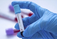 Panik yaşanmaması için gerçeği söyleyin