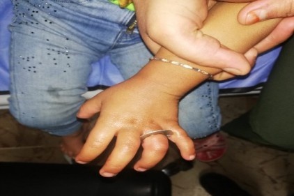 Parmağına sıkışan cıvata pulunu itfaiye ekipleri çıkardı 