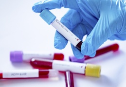 Pozitif vaka sayısı hızla artıyor