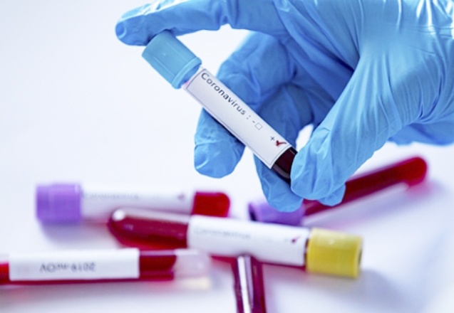 Pozitif vaka sayısı hızla artıyor