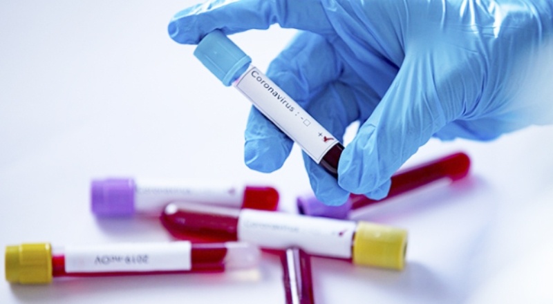 Pozitif vaka sayısı hızla artıyor