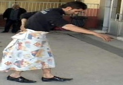 Soba yakmak isterken kendisini yaktı 