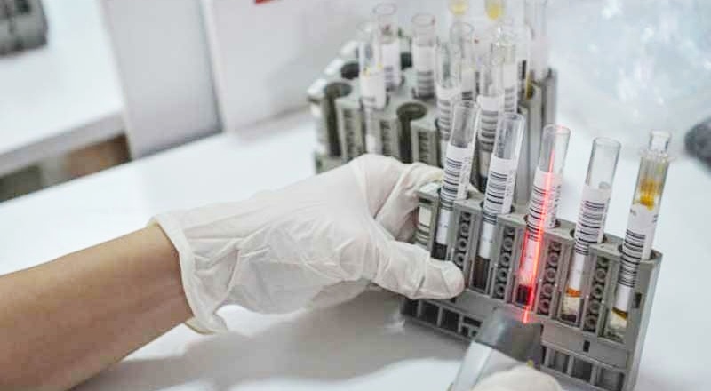 Test ihalesi Menzil tarikatına ait şirkete verildi: 144 milyon lira ödenecek