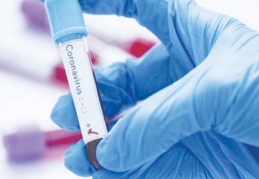 Tokyo 2020'de COVID-19 sayısı 382 oldu