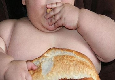 'Türkiye'de 3 milyon obez var'