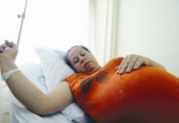 Türkiye'deki doğumların yüzde 58'i sezaryen