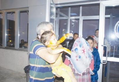 Üzerine kaynar su döküldü