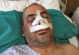 Uzman jandarmayı öldüresiye dövdüler