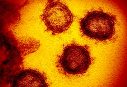 Vee… Mutasyonlu virüs Gaziantep’te!!!