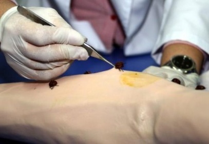 Vücutta kene olmasa da dikkat edin