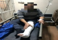 Yakalanmamak için ikinci kattan atladı