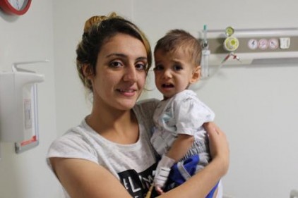 Yemek borusu olmayan bebeğin midesi yukarı çekildi