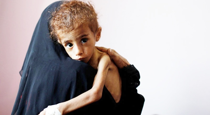 Yemen'de 400 bin çocuk açlıktan ölmek üzere