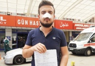 Yine sağlık çalışanına saldırı! Burnu üç yerden kırıldı