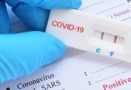 Yurt dışına çıkanlar Covid-19 testi için 'IBAN'a 110 TL yatıracak'