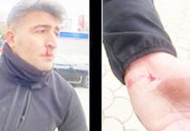 Zabıta ekiplerine sopalı bıçaklı saldırı: 2 yaralı